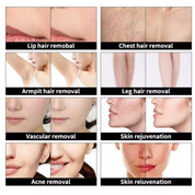 Pro IPL Hair Removal & Skin Renewal System – PuraSkin