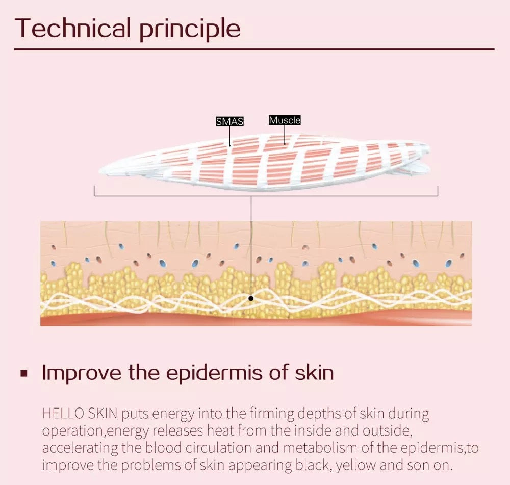 Technical principle
