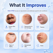 9-in-1 Hydro Facial Machine with Vortex Fusion - Super Ellipse