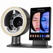 DermaScope AI Skin Analysis System