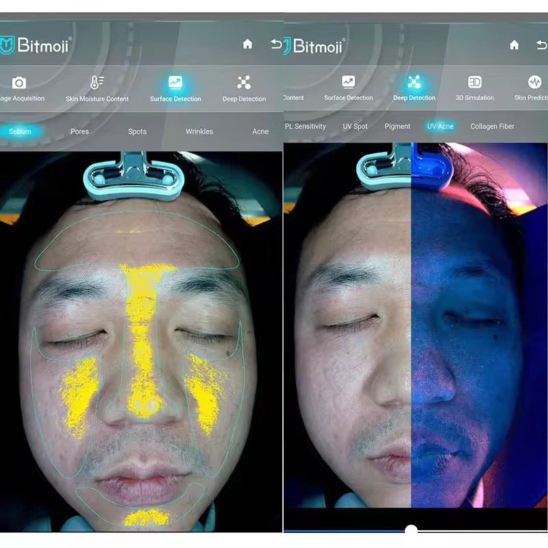 Skin Analysis Machine MOJI