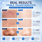 H2Glow 2-in-1 Hydra Facial System