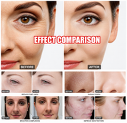 17 In 1 Hydra Skin Care System Facial Machine Elite