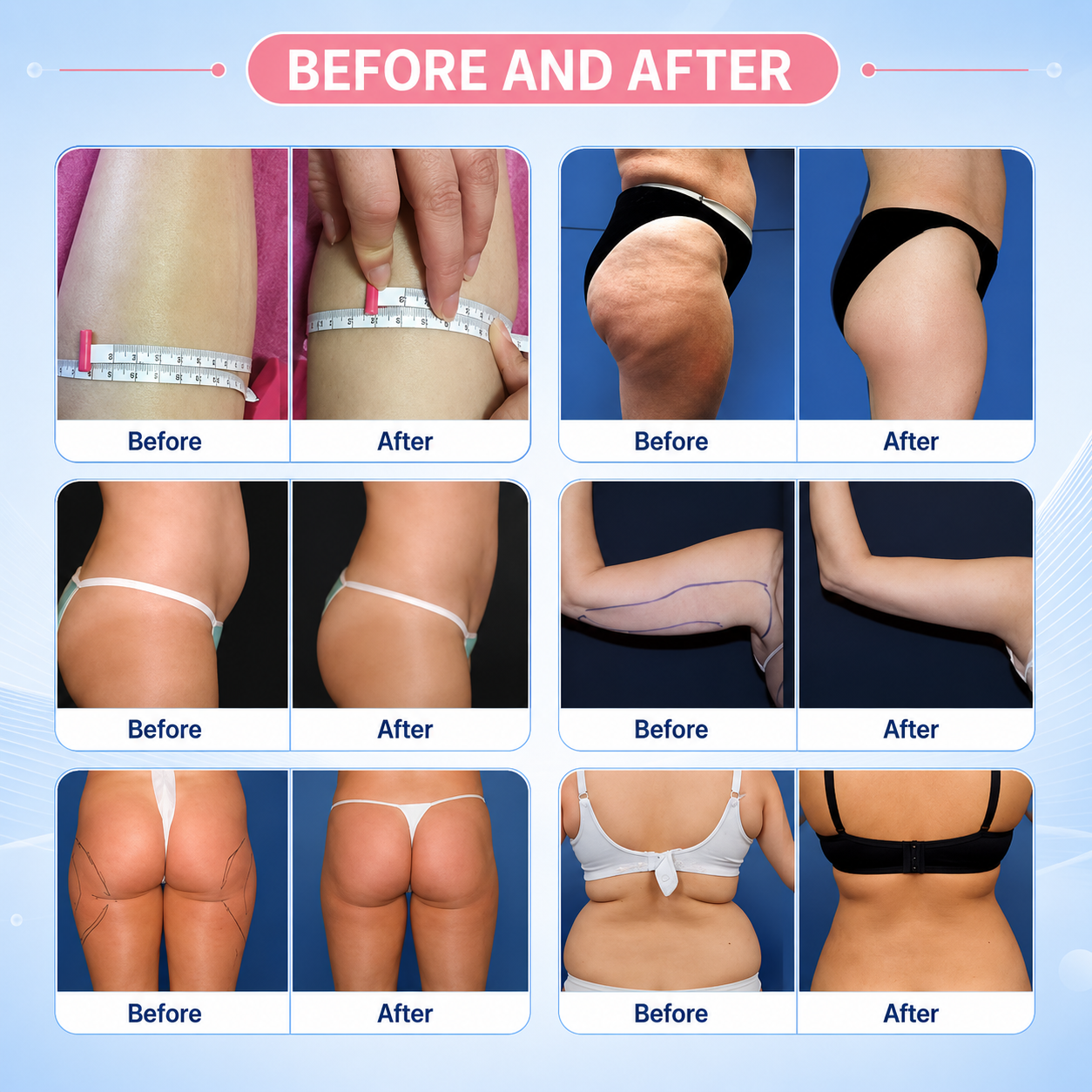 Lipo Laser 40K Cavitation Slimming Machine 6 in 1
