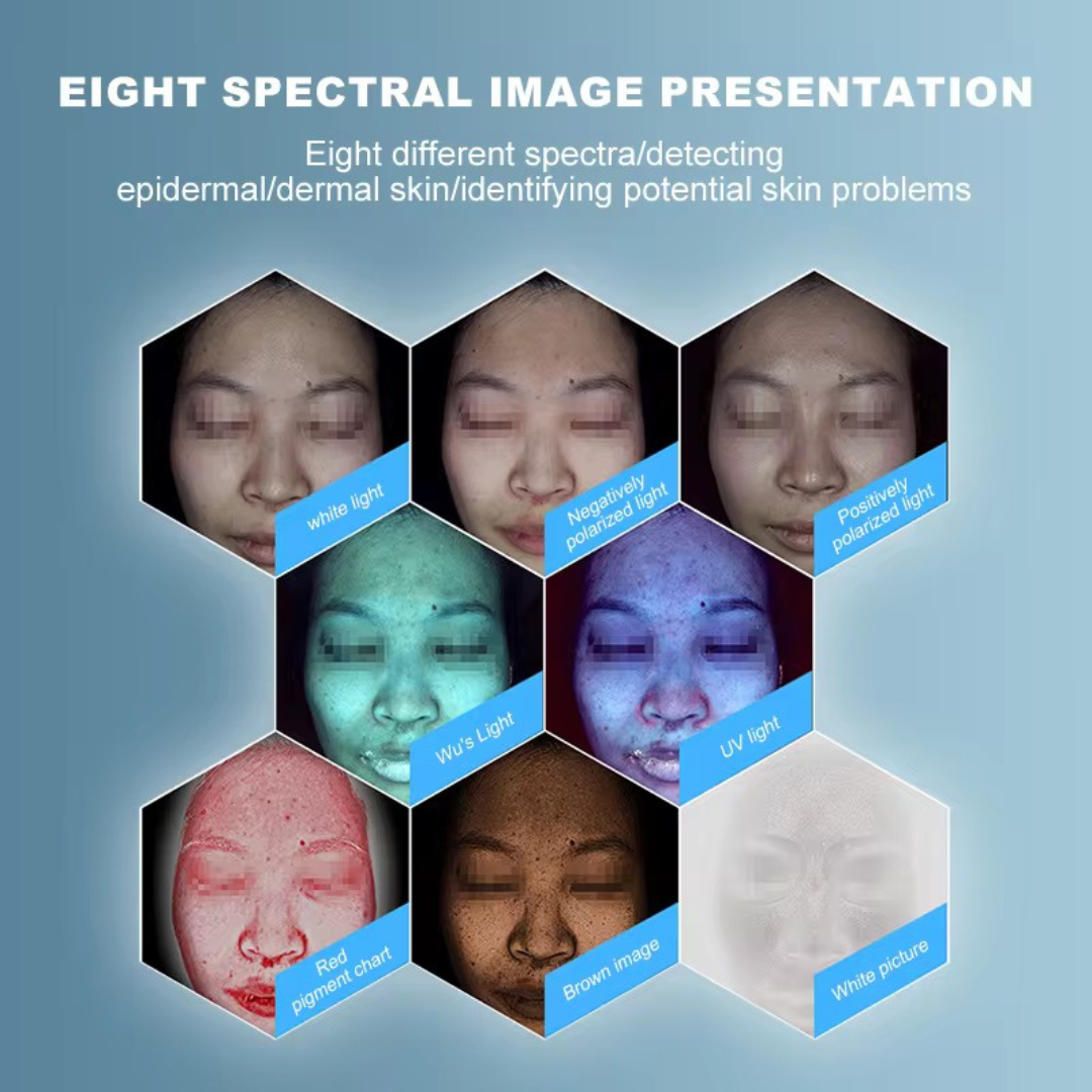 Skin Analysis Machine MOJI