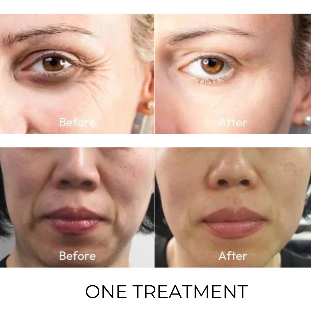 One_treatment.zip_-_7_b1c7ce7d-5ec6-4280-b6a7-1428b499f815.png
