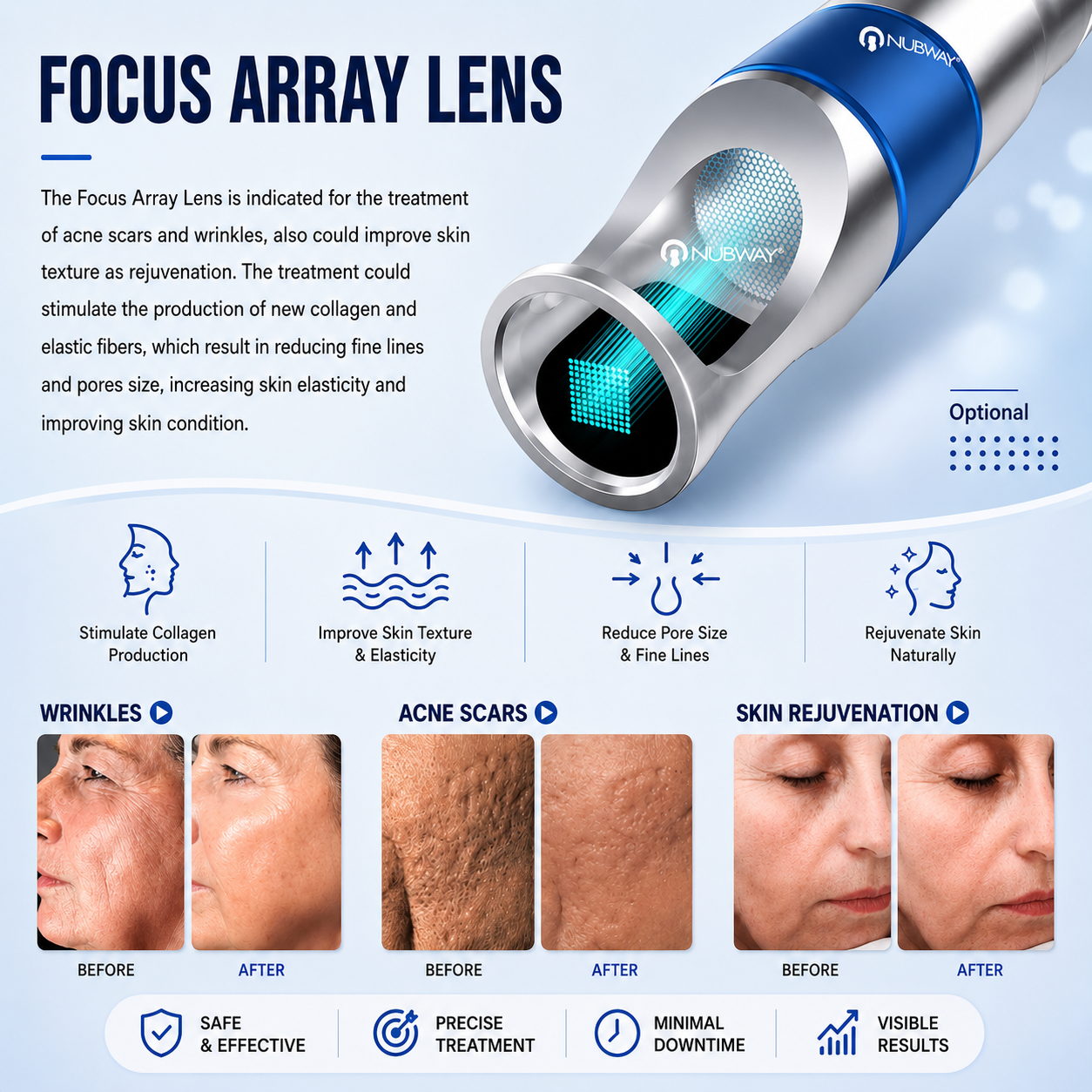 Laser Tattoo Removal Machine PicoLITE*