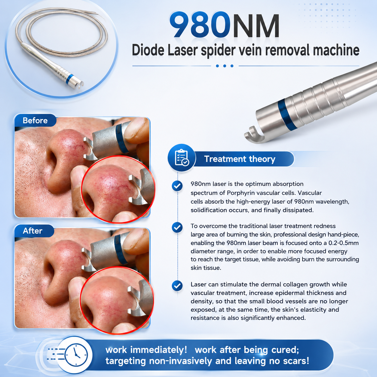 Spider Veins Laser Removal Machine 980nm Diode Laser