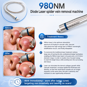 Spider Veins Laser Removal Machine 980nm Diode Laser