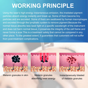 Laser Tattoo Removal Machine Quita